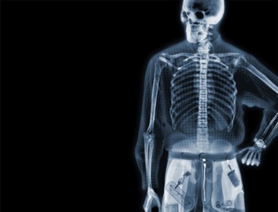 首页 医疗影像 x光机与技术 > 全面透视人体的神奇 探秘x射线下的人体